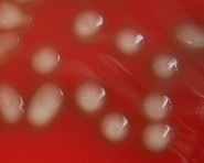 what hemolysis has pneumoococcus?